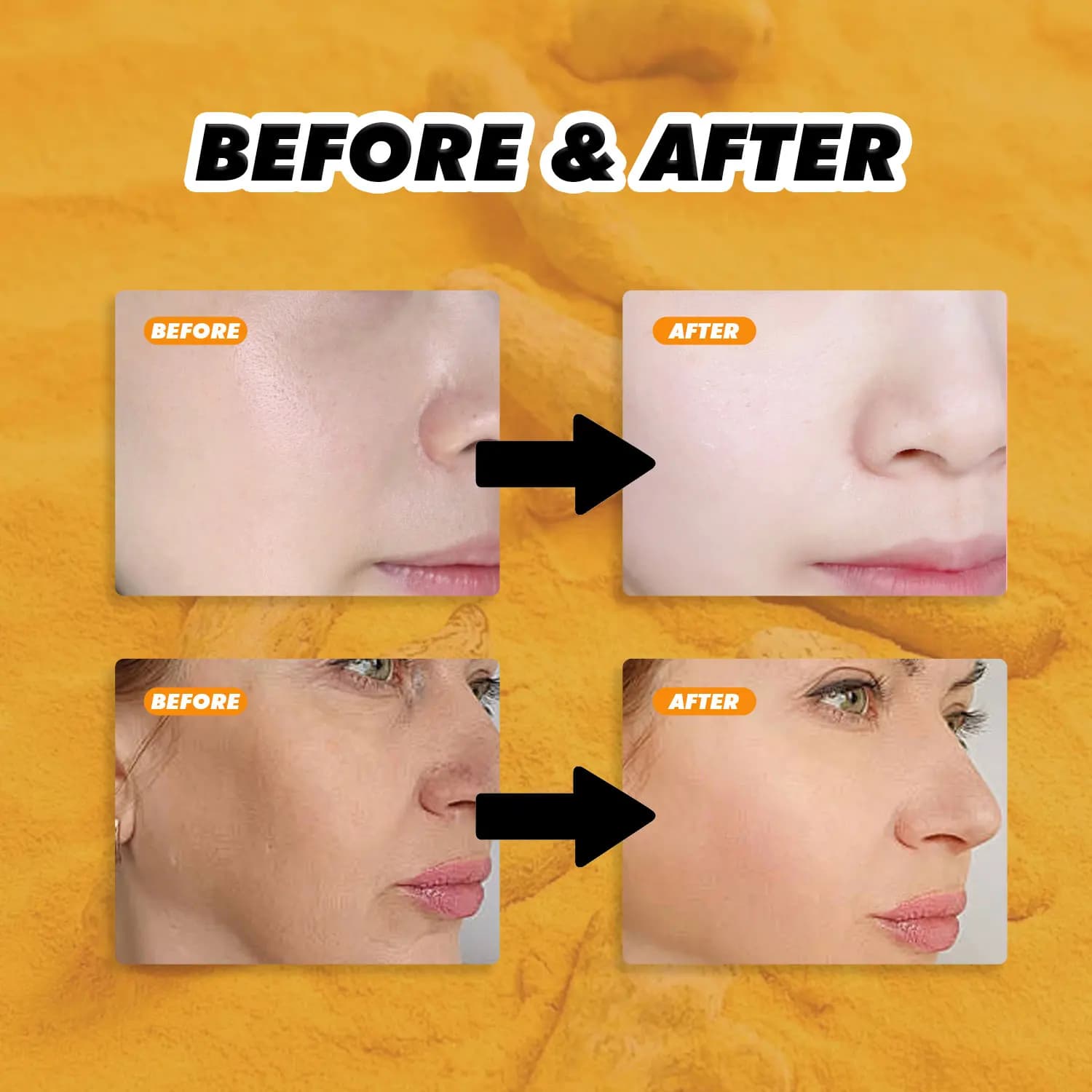 Turmeric Honey Face Oil and Moisturizing Cream Set
