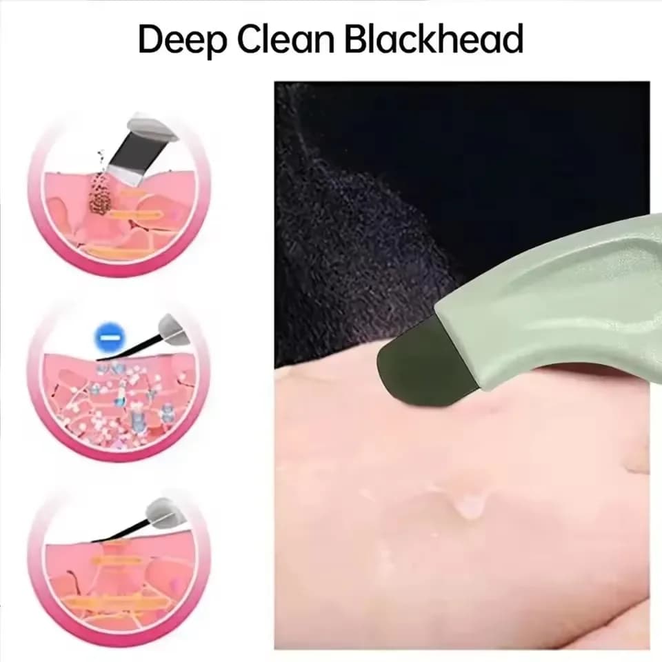 Facial Blackhead Removal Scraper Tool