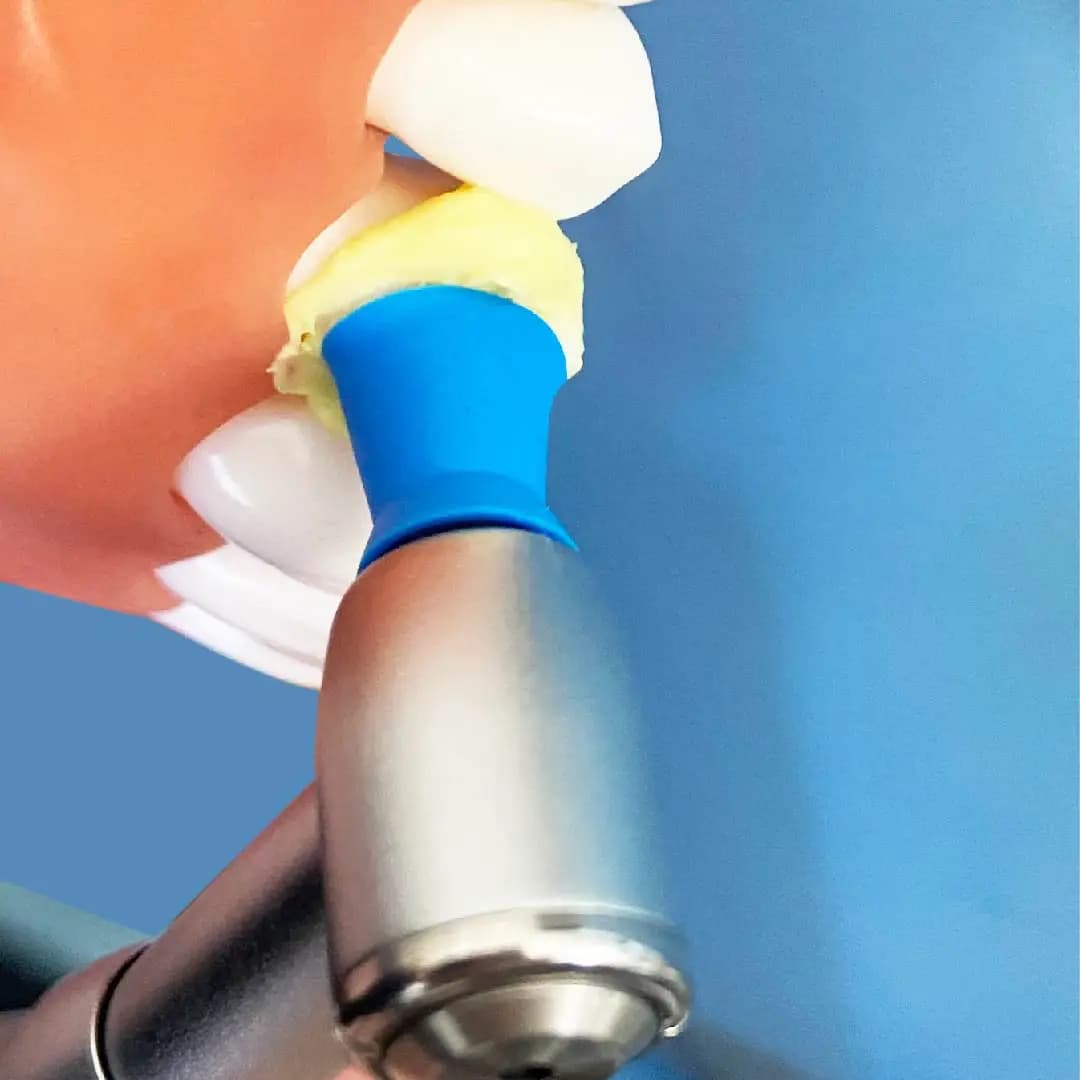 Dental Prophy Polishing Paste