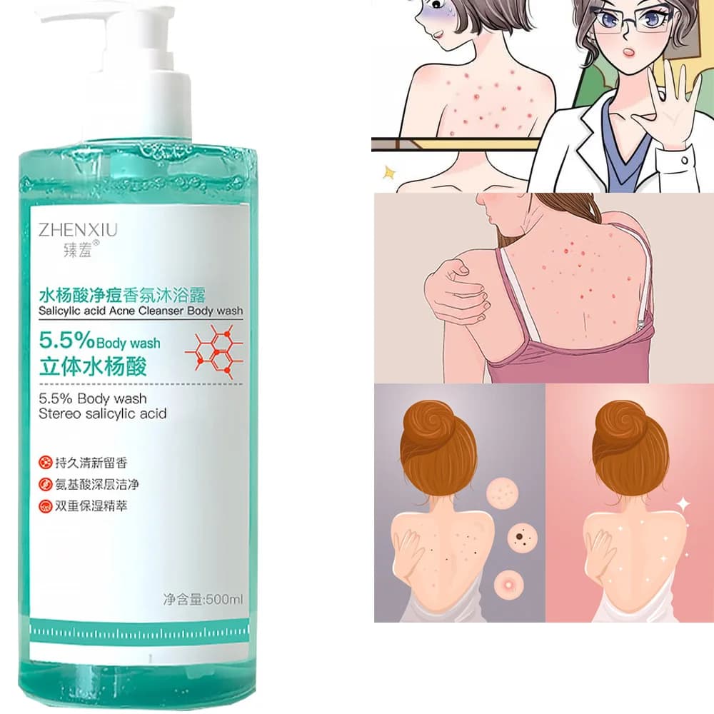 Salicylic Acid Body Wash for Acne