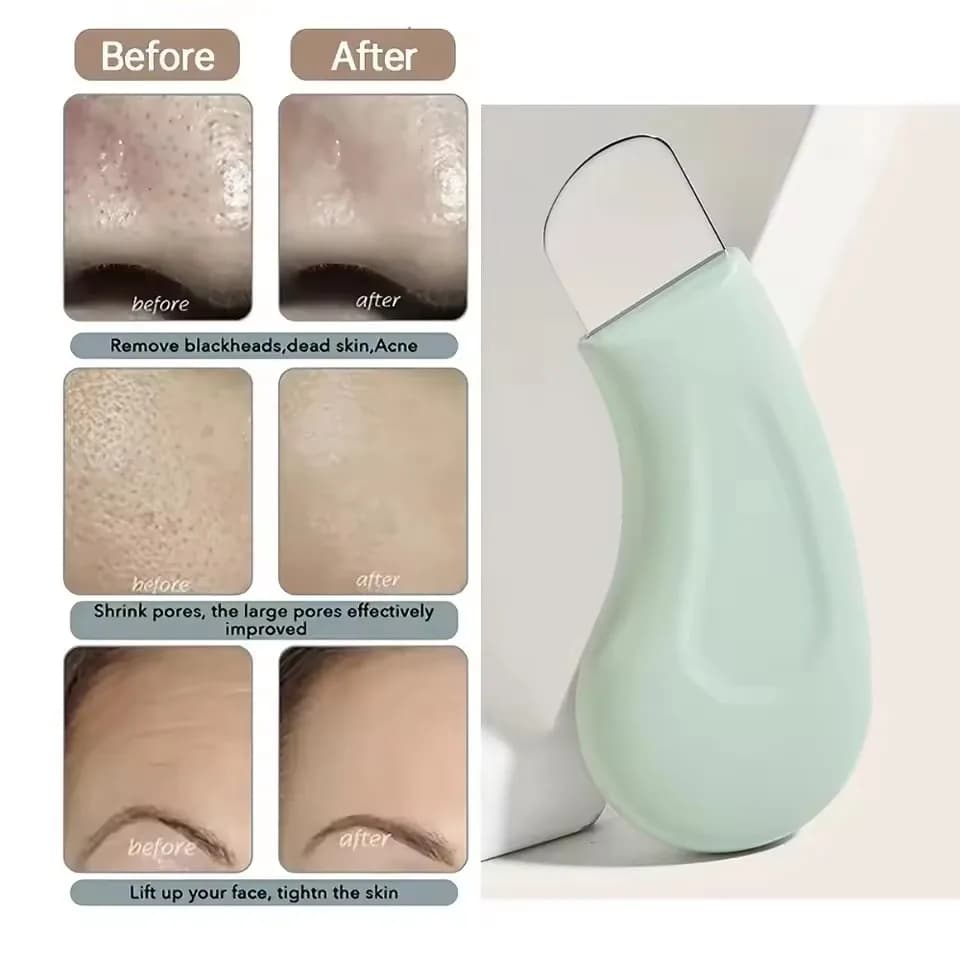 Facial Blackhead Removal Scraper Tool