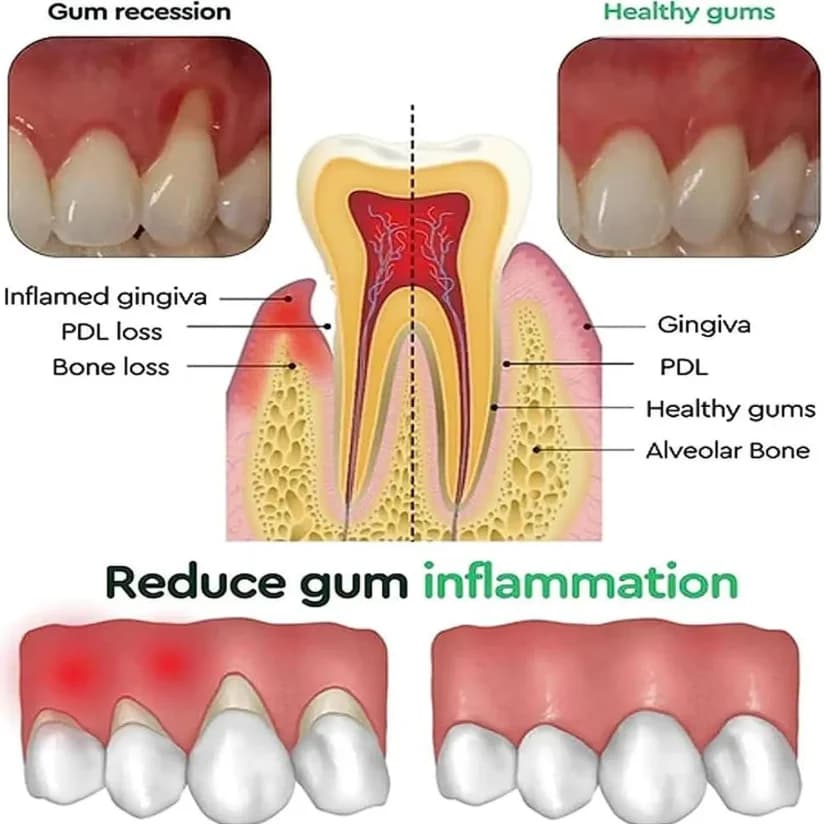 Gentle Natural Gum Care Liquid