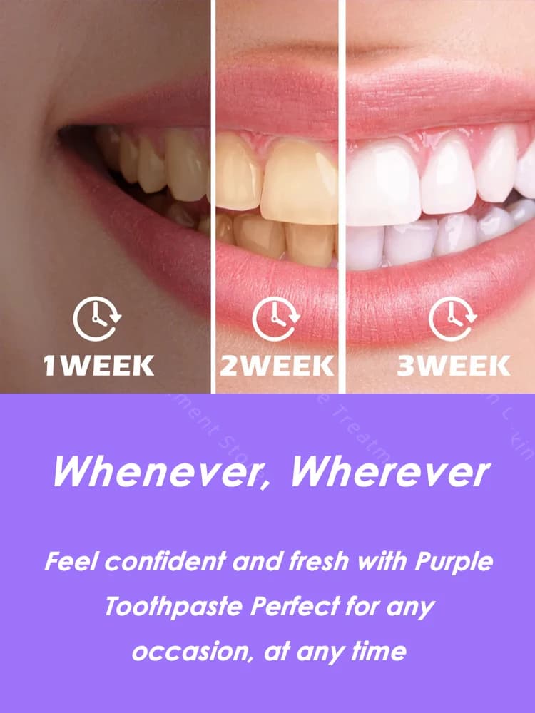 Fruit Flavored Toothpaste Variety Pack