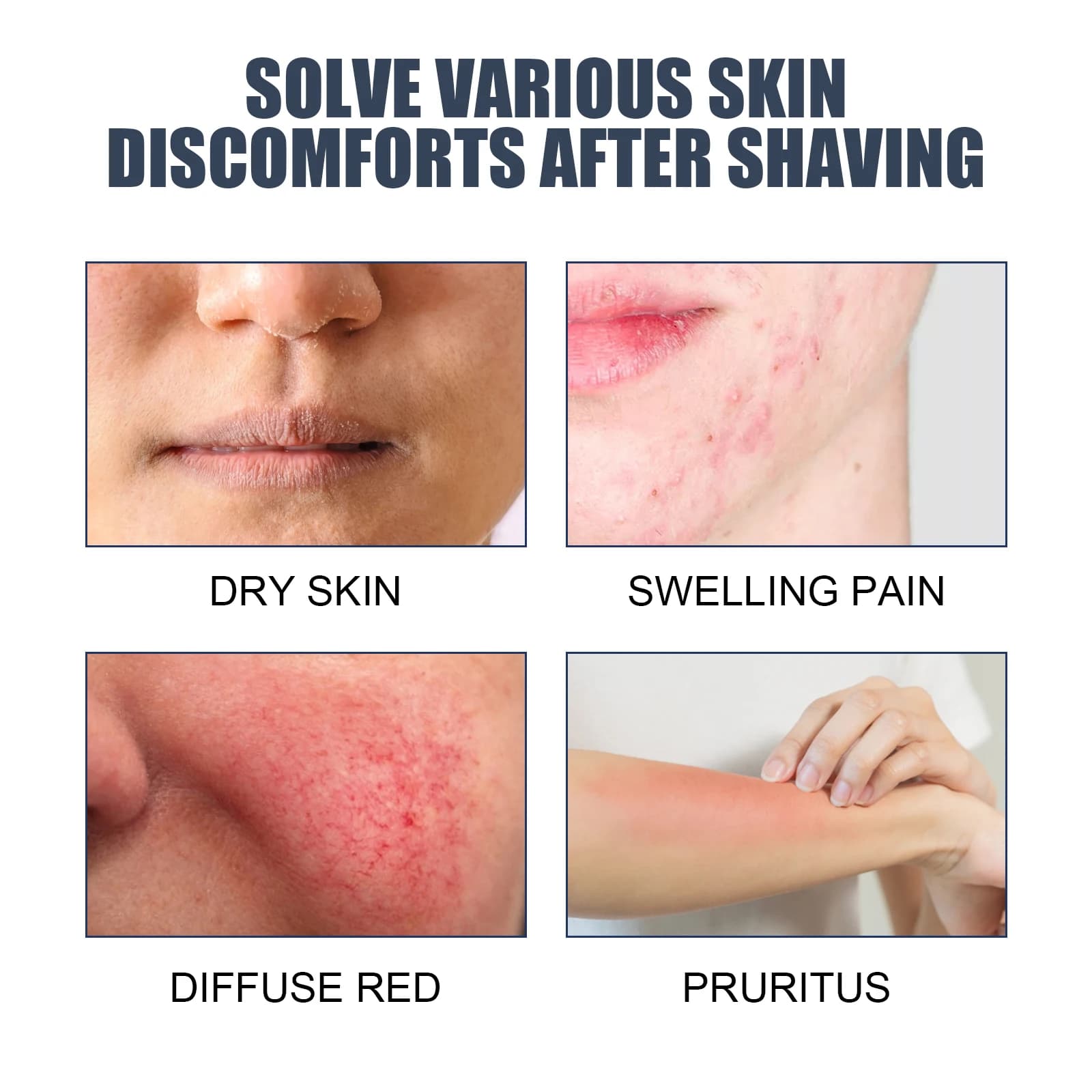 Men's After Shave Balm Moisturizer