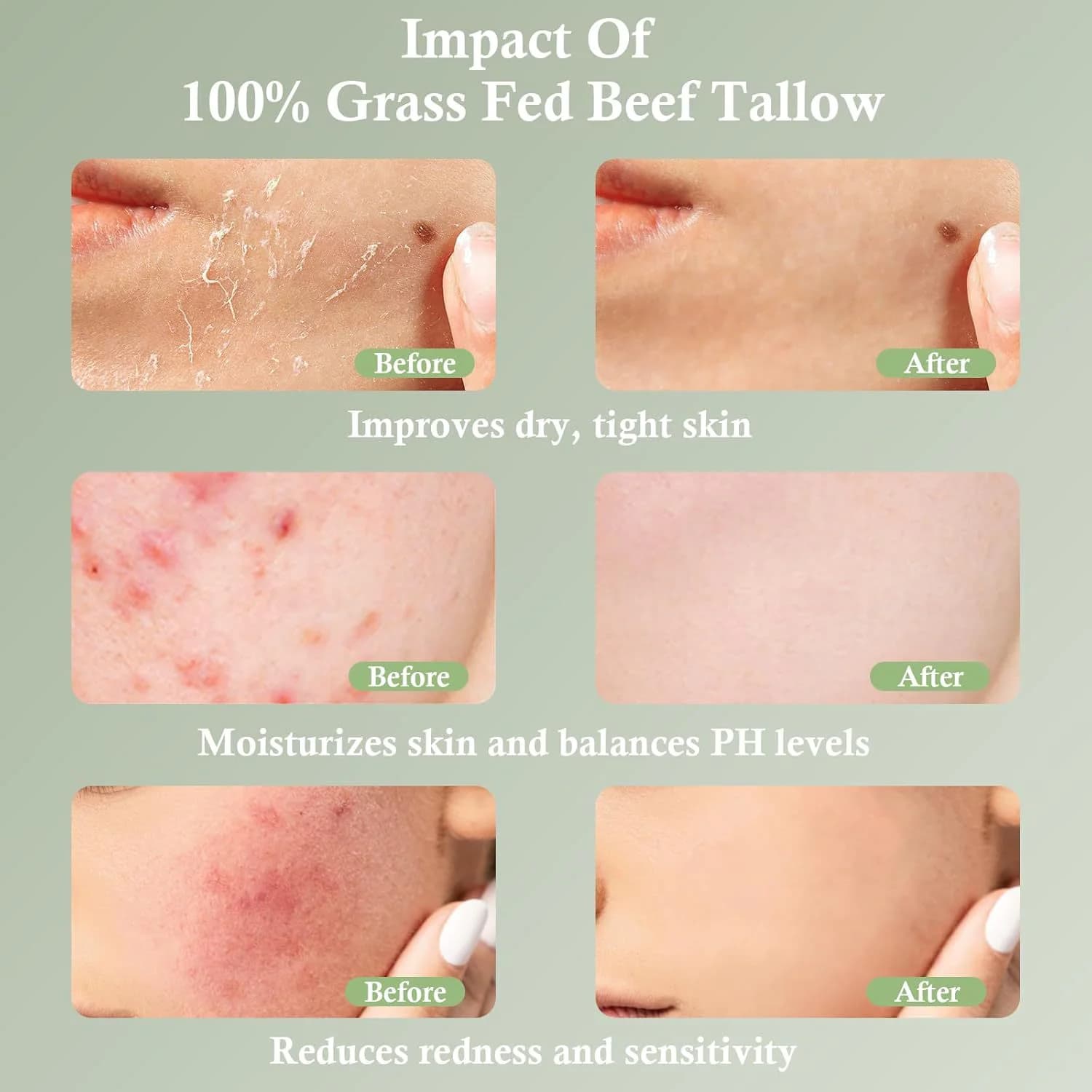 Grass-Fed Tallow Moisturizing Cream – Soothing & Nourishing Skincare